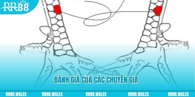 mcw 87 V8 Game Bài 3d